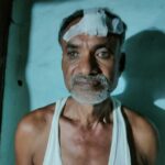 भाजपा नेता और सेवा सहकारी समिति अध्यक्ष पर जानलेवा हमला, सगे भाई पर केस दर्ज